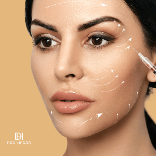 BOTOX 3 ZONAS + 1 ML DE ÁCIDO HIALURÓNICO